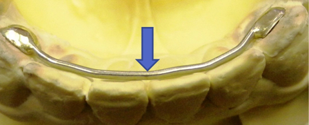 Ordont Orthodontic Appliance Laboratories