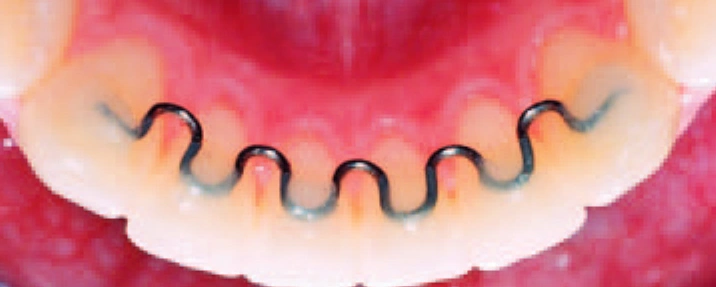 Ordont Orthodontic Appliance Laboratories