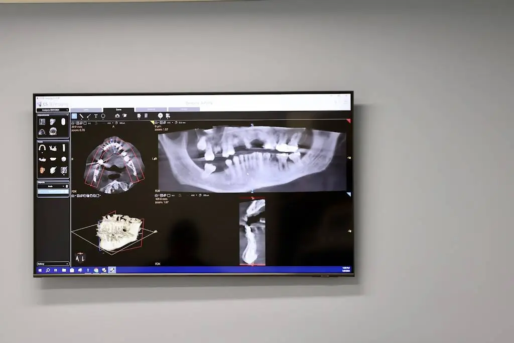 NuSet Dental Implants and Oral Surgery of St Louis