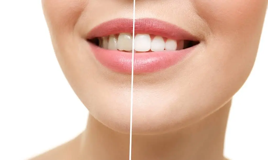 Elite Smiles PLLC