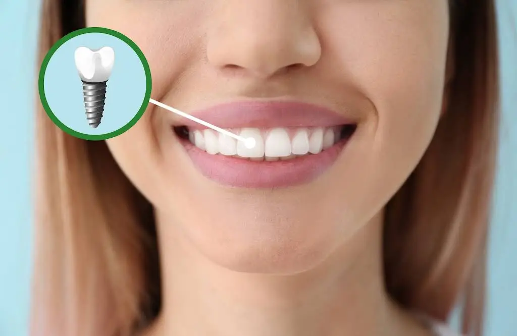 Elite Smiles PLLC