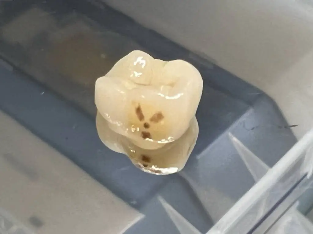 Semtner Dental