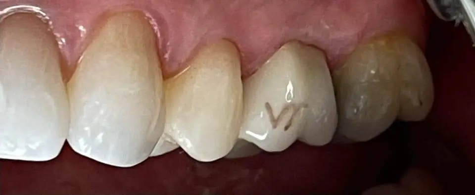 Semtner Dental