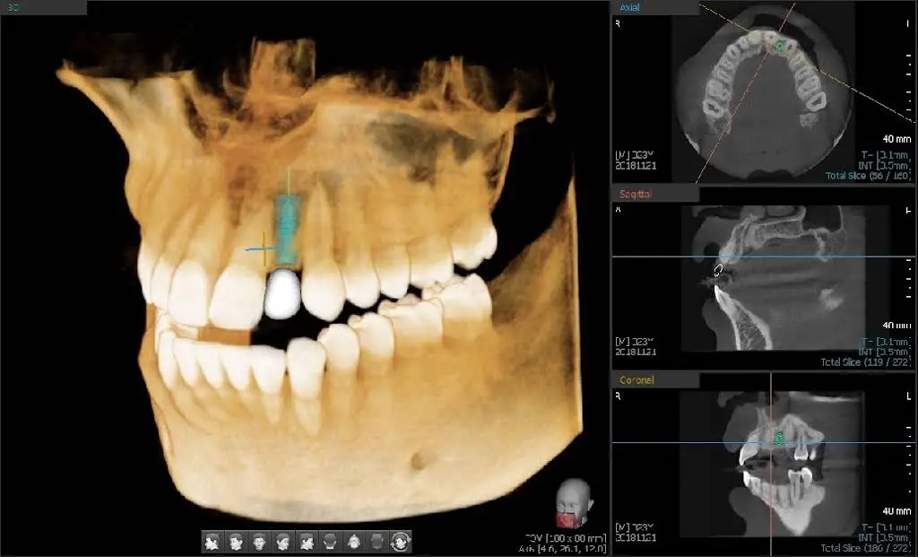 Clemmons Comprehensive Dental Care