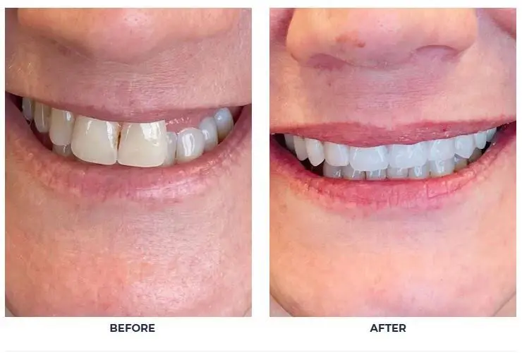 Virginia Dental Implant Institute