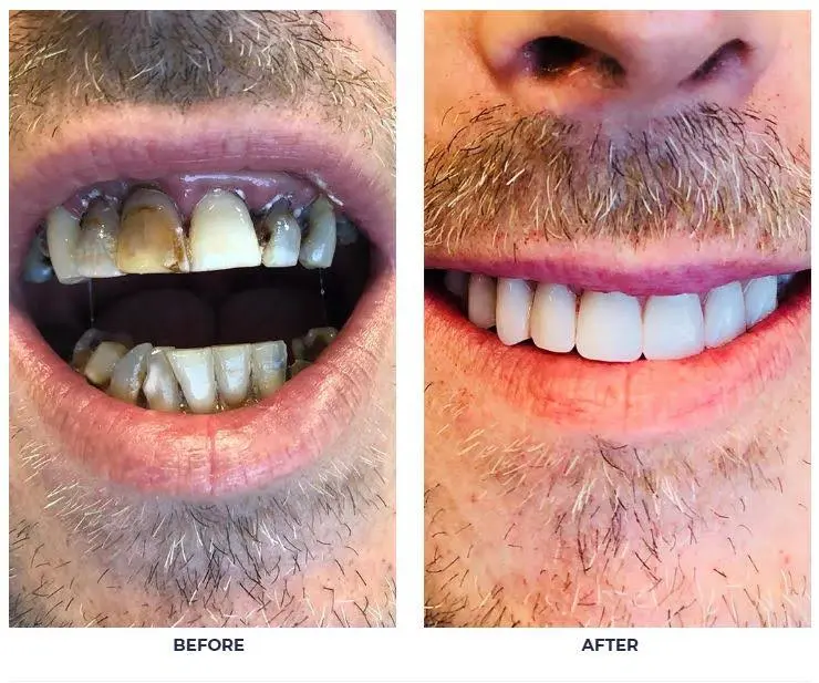 Virginia Dental Implant Institute