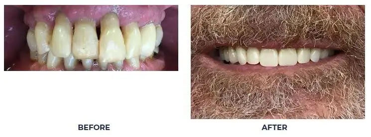 Virginia Dental Implant Institute
