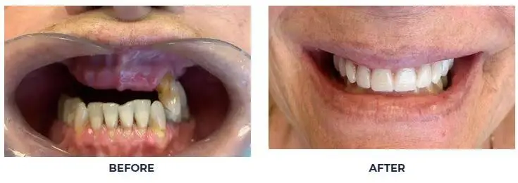 Virginia Dental Implant Institute