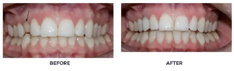 Virginia Dental Implant Institute