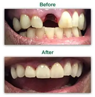 Millcreek Dental Arts - Keith C. Schloss DMD