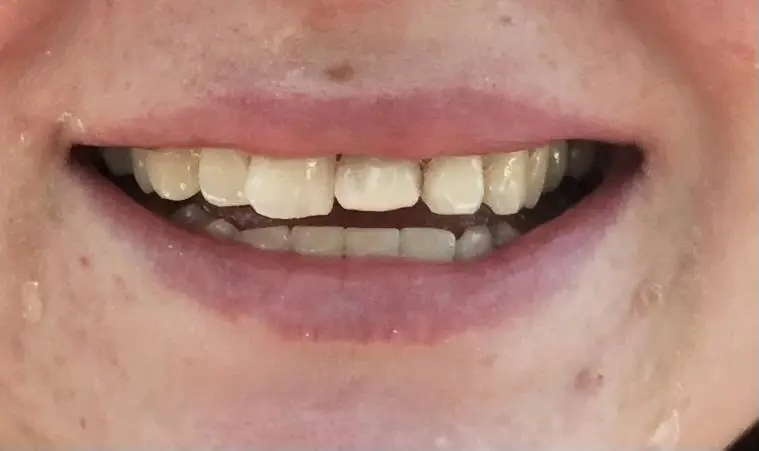 STL Urgent Dental