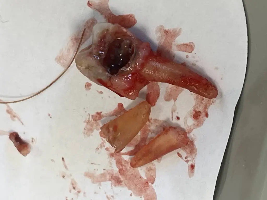 STL Urgent Dental