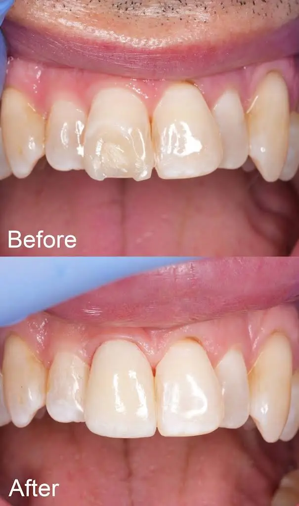 Dental Partners of Creve Coeur