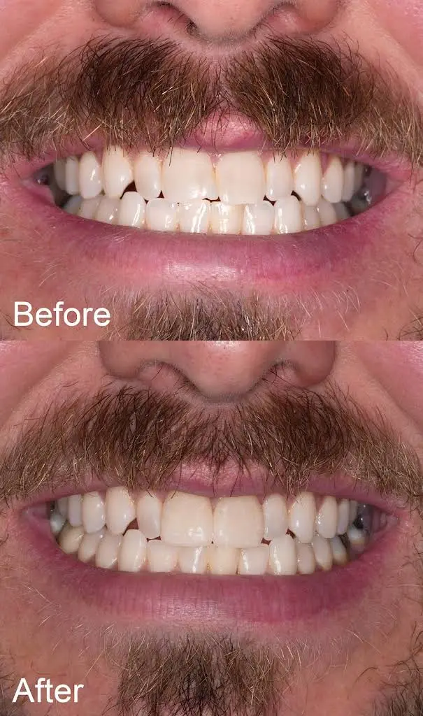 Dental Partners of Creve Coeur