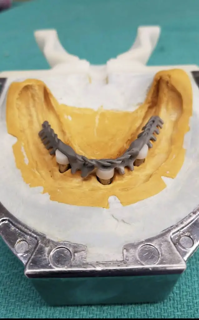 Chesterfield Woodlake Dental and Prosthodontics