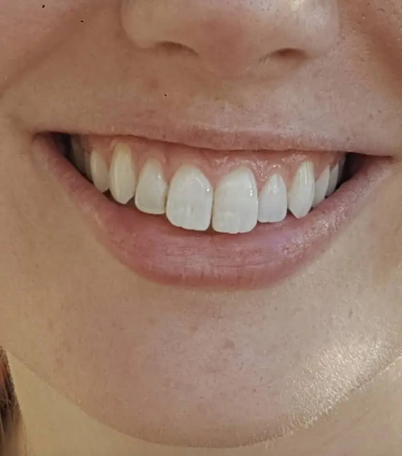 Chesterfield Woodlake Dental and Prosthodontics