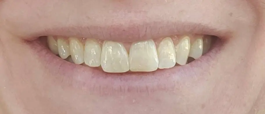 Restoration Dental of Winston-Salem