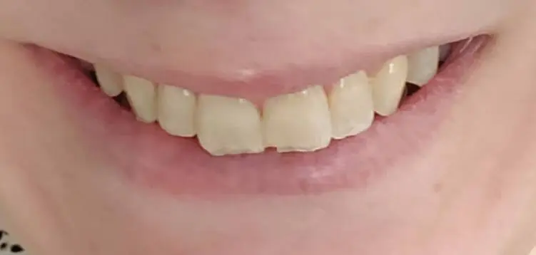 Restoration Dental of Winston-Salem