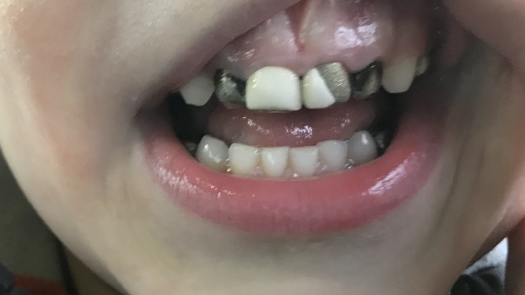 Kool Smiles Dentist
