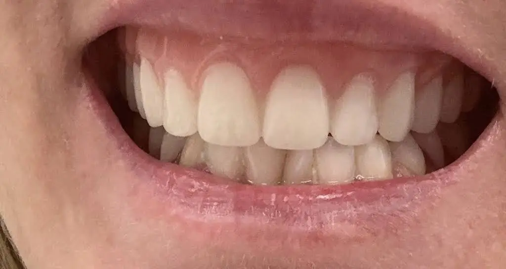 Aspen Dental