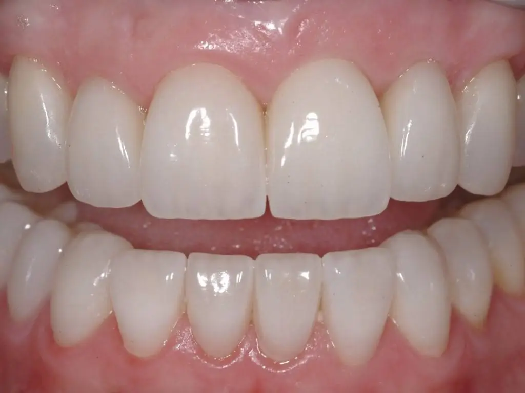 Blue Mountain Dental Care