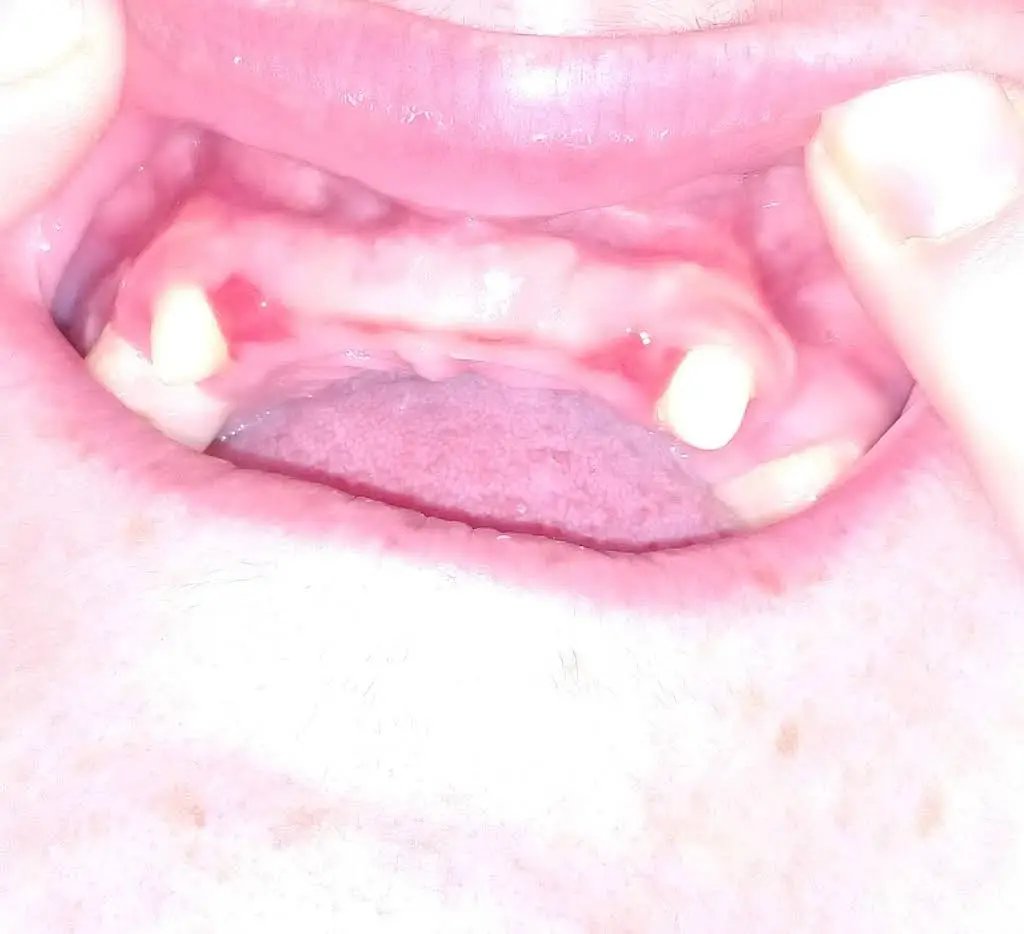 Blue Mountain Dental Care