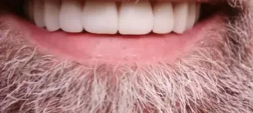 Affordable Dentures & Implants