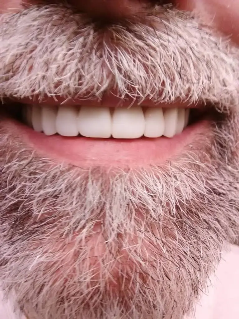 Affordable Dentures & Implants