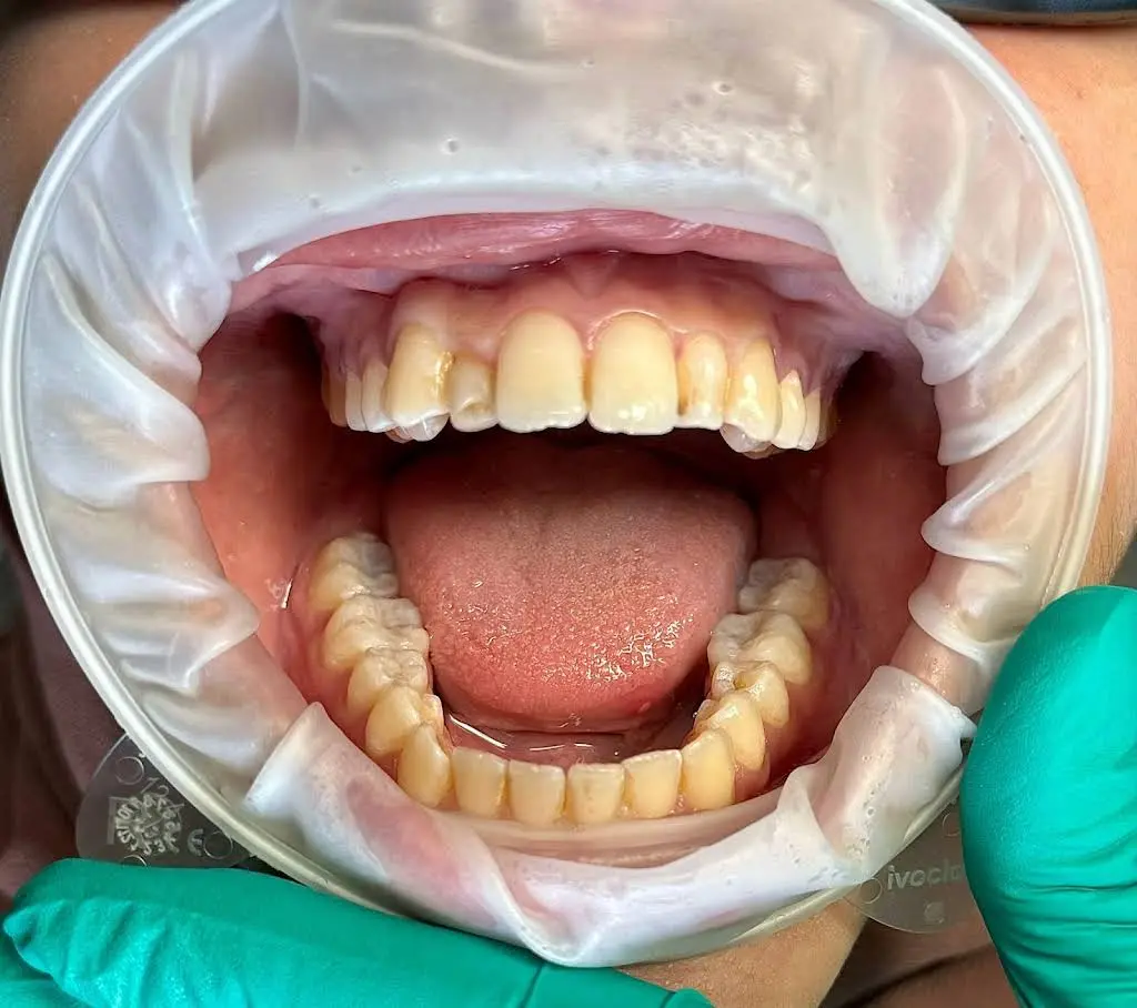 Hidden Creek Dental Care