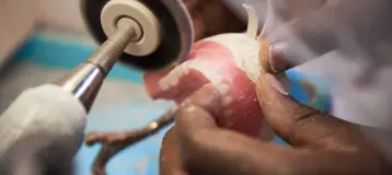 Affordable Dentures & Implants