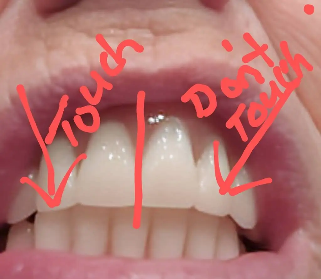 Affordable Dentures & Implants