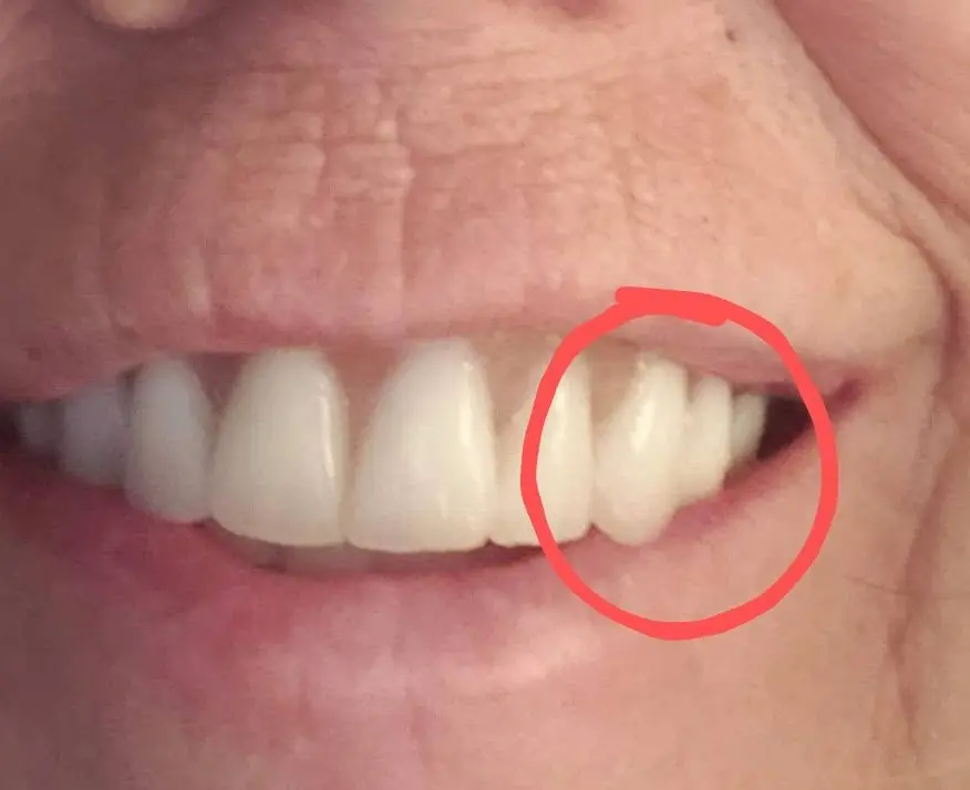 Affordable Dentures & Implants