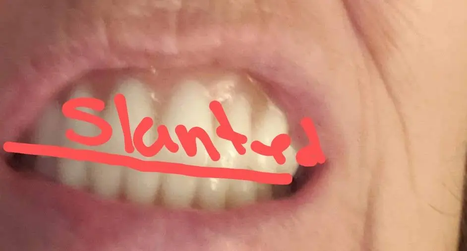 Affordable Dentures & Implants