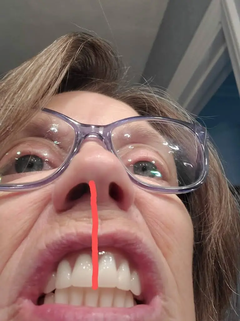 Affordable Dentures & Implants
