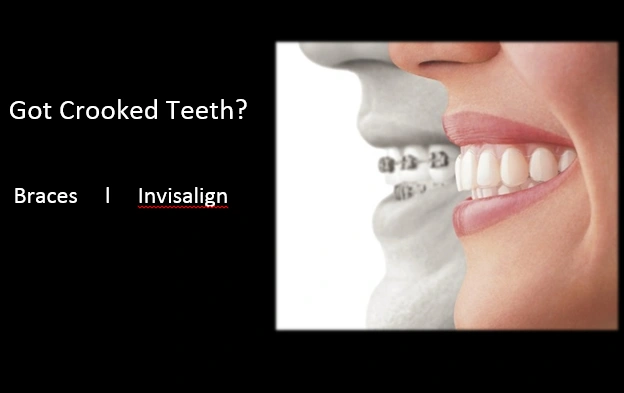 RS Orthodontics