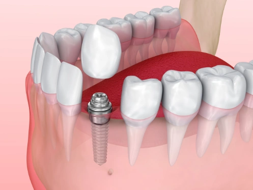 Reichel Dental