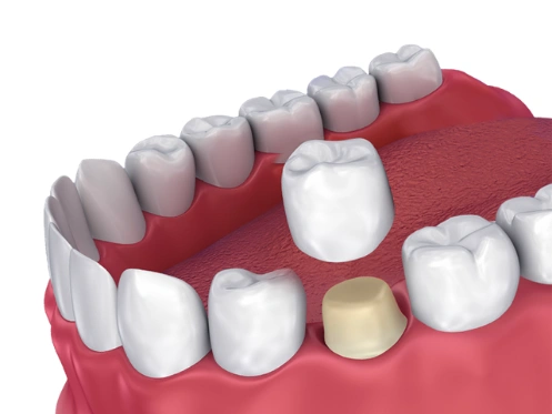Reichel Dental