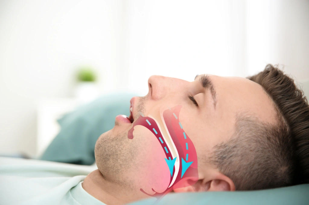 Midwest Dental Sleep Medicine Institute