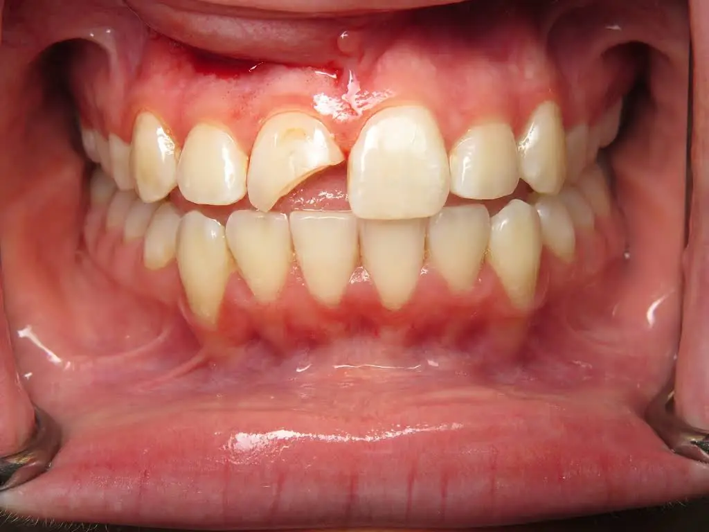 Michael C. Cordora, DDS, AGD Fellow
