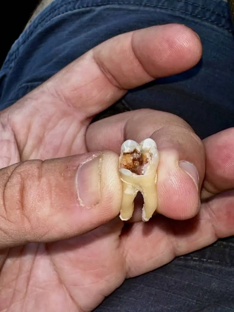Catawba Valley Dental: Pate Raymond G DMD,PA
