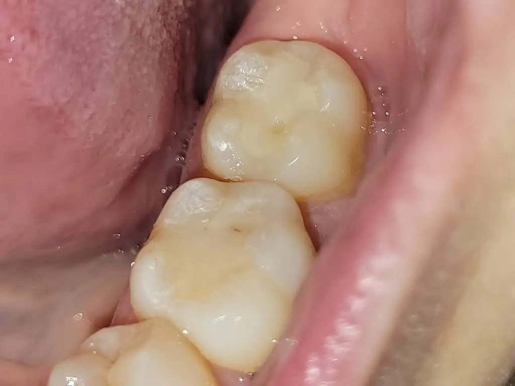 Salem Dental Associates
