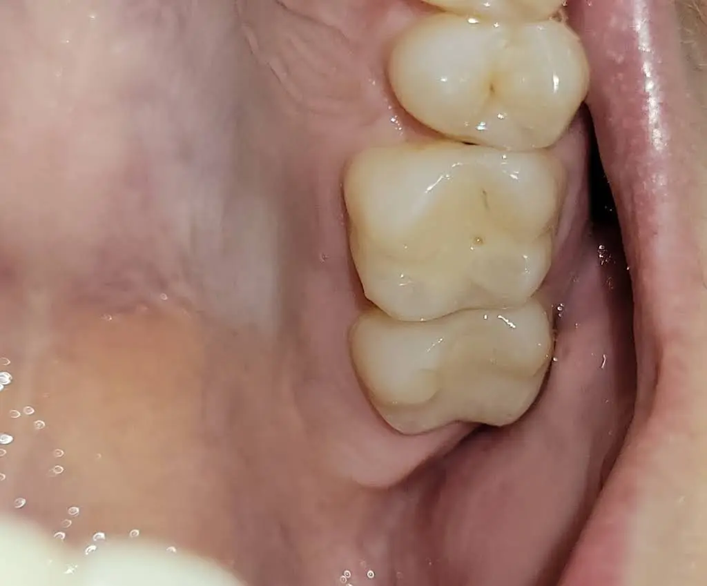 Salem Dental Associates
