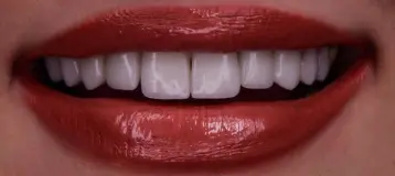 Lakeshore Dentistry