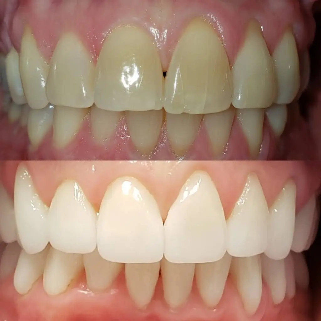 Lakeshore Dentistry