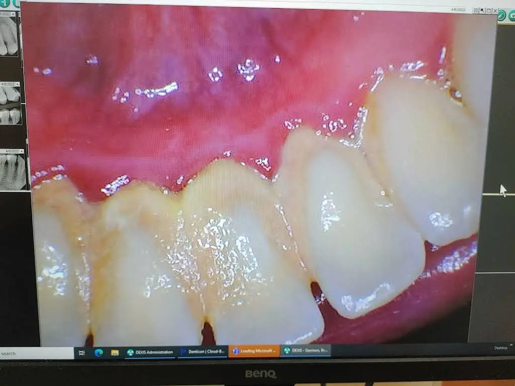 Dentist in Winston-Salem