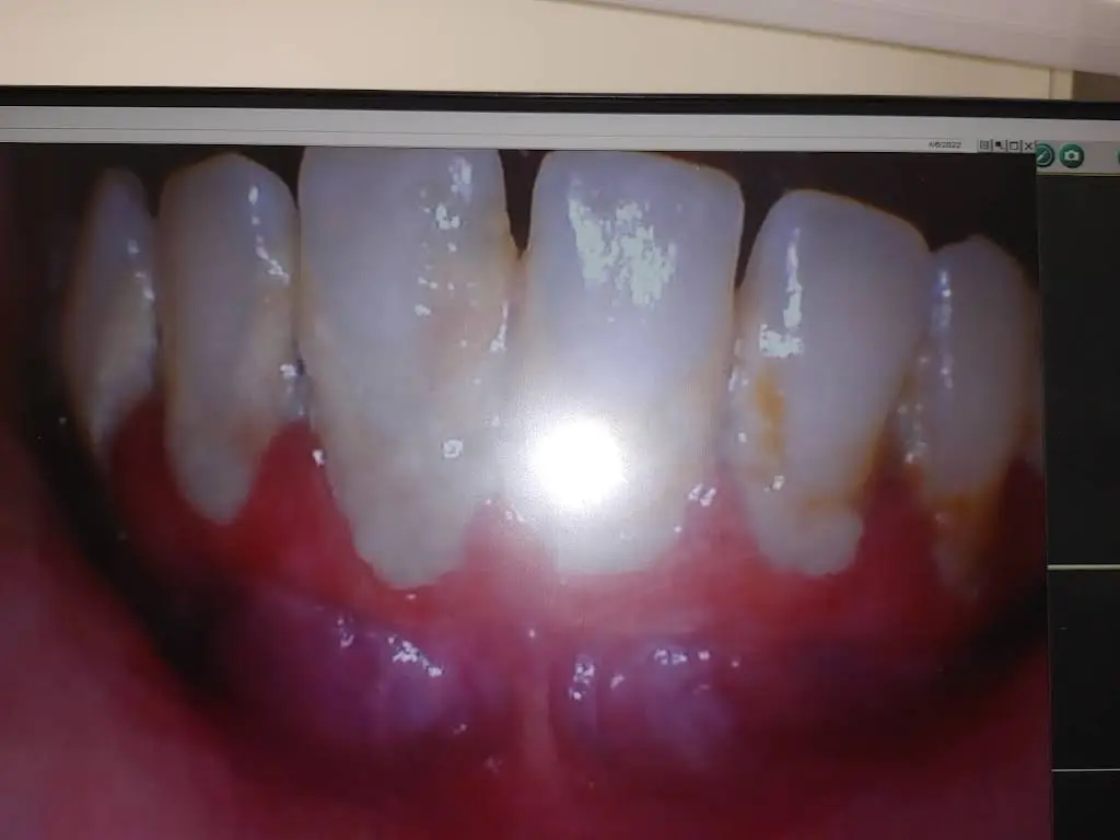 Dentist in Winston-Salem