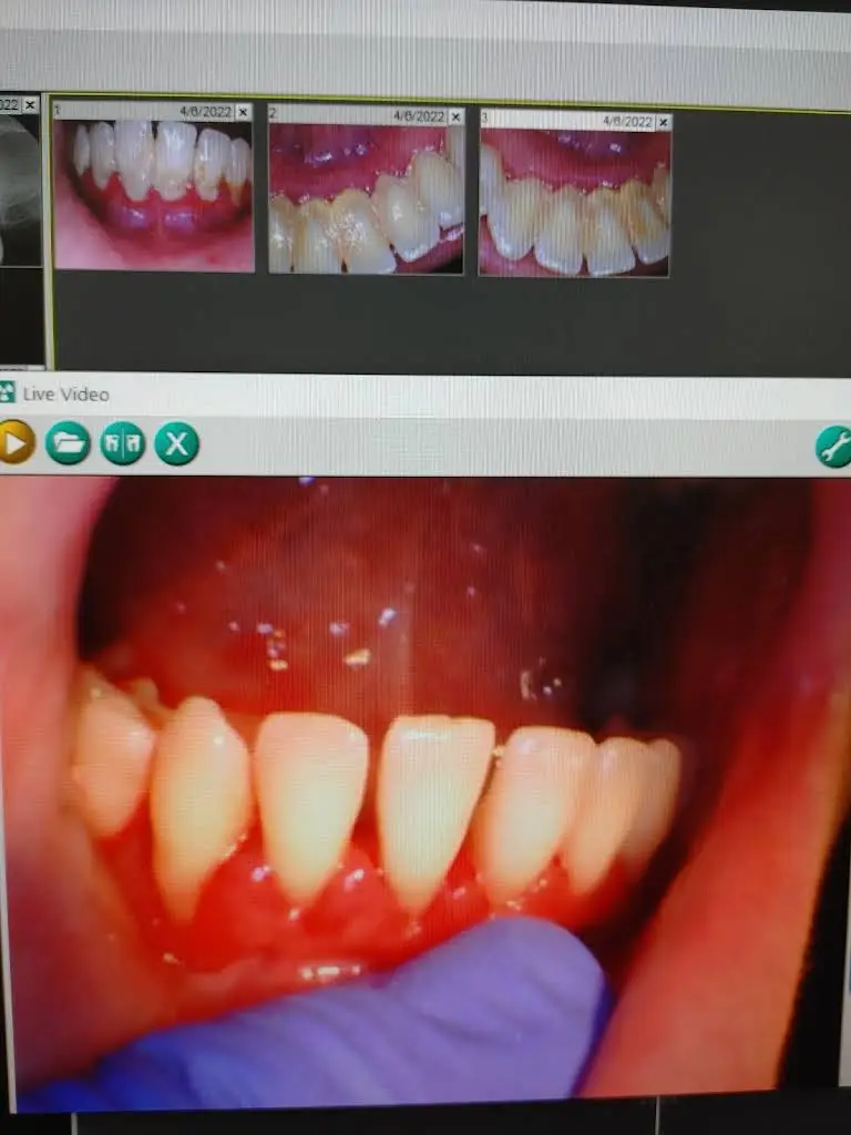 Dentist in Winston-Salem
