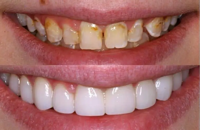 Dr. Lee J. Simon, DDS
