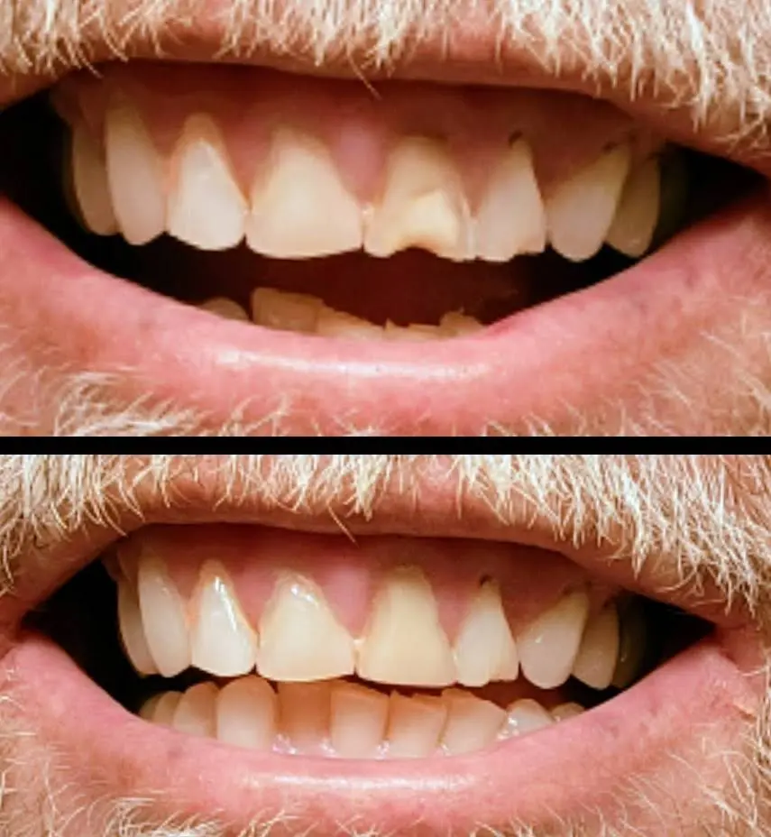 Akhrass Dental Implant & Cosmetic Center