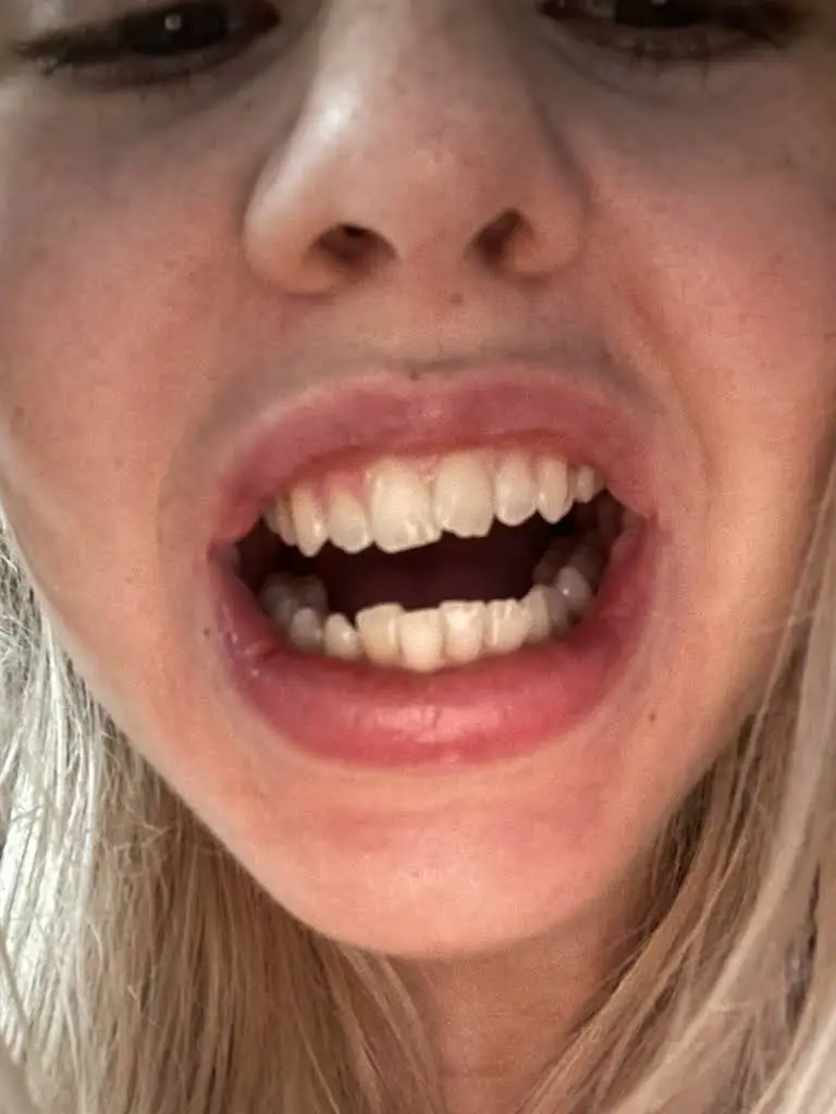 Aspen Dental